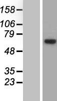 ls001936 eef1d human over expression lysates nm 032378 wb testing 1