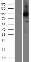 EEF2 Human Over-expression Lysates NM_001961