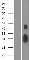 Ephrin A4 (EFNA4) Human Over-expression Lysates NM_182690