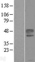 Ephrin B1 (EFNB1) Human Over-expression Lysates NM_004429