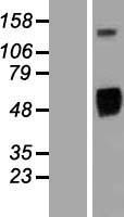 ls001956 egfr human over expression lysates nm 201283 wb testing 1