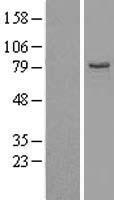 EHHADH Human Over-expression Lysates NM_001966