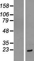 eIF1A (EIF1AX) Human Over-expression Lysates NM_001412