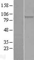 elF2 alpha (EIF2S1) Human Over-expression Lysates NM_004094