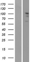 Eph receptor A2 (EPHA2) Human Over-expression Lysates NM_004431