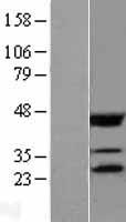 EIF4E Human Over-expression Lysates NM_001968