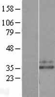 Neutrophil Elastase (ELANE) Human Over-expression Lysates NM_001972