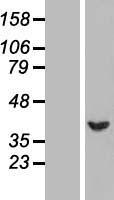 SERPINB1 Human Over-expression Lysates NM_030666