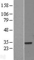 ELF5 Human Over-expression Lysates NM_001422