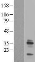 Emerin (EMD) Human Over-expression Lysates NM_000117