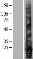 ls002012 emp1 human over expression lysates nm 001423 wb testing 1