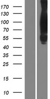 Cortactin (CTTN) Human Over-expression Lysates NM_005231