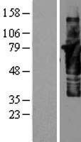 Cortactin (CTTN) Human Over-expression Lysates NM_138565
