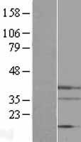 Endo G (ENDOG) Human Over-expression Lysates NM_004435