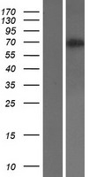 CD105 (ENG) Human Over-expression Lysates NM_001114753