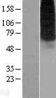 ENT1 (SLC29A1) Human Over-expression Lysates NM_001078174