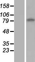 ENT1 (SLC29A1) Human Over-expression Lysates NM_001078175