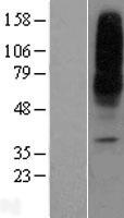ENT1 (SLC29A1) Human Over-expression Lysates NM_001078177