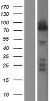 ls002035 epb41 human over expression lysates nm 001166007 wb testing 1