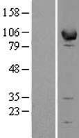 EPB41L1 Human Over-expression Lysates NM_177996