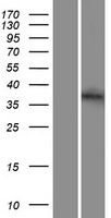Syntaxin 2 (STX2) Human Over-expression Lysates NM_194356