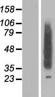 CLN8 Human Over-expression Lysates NM_018941