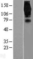 EPS15 Human Over-expression Lysates NM_001981