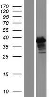 ERCC1 Human Over-expression Lysates NM_001983