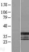 ERCC1 Human Over-expression Lysates NM_202001