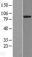 XPD (ERCC2) Human Over-expression Lysates NM_000400