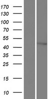 XPD (ERCC2) Human Over-expression Lysates NM_001130867