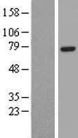 EYA4 Human Over-expression Lysates NM_172103
