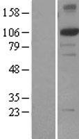 XPF (ERCC4) Human Over-expression Lysates NM_005236