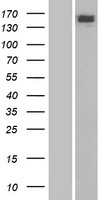 ls002074 csb ercc6 human over expression lysates nm 000124 wb testing 1