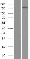 IRE1 (ERN1) Human Over-expression Lysates NM_001433