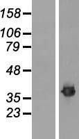 Fibrillarin (FBL) Human Over-expression Lysates NM_001436