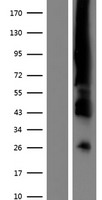 Estrogen Receptor 1 (ESR1) Human Over-expression Lysates NM_001122740