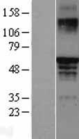 ls002100 estrogen receptor beta esr2 human over expression lysates nm 001437 wb testing 1