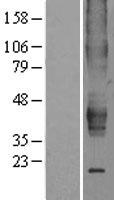 Estrogen Related Receptor beta (ESRRB) Human Over-expression Lysates NM_004452