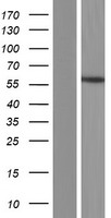 Estrogen Related Receptor beta (ESRRB) Human Over-expression Lysates NM_004452