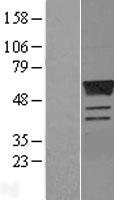 Estrogen Related Receptor gamma (ESRRG) Human Over-expression Lysates NM_001438