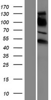 Estrogen Related Receptor gamma (ESRRG) Human Over-expression Lysates NM_206594