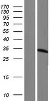 ls002108 etfa human over expression lysates nm 001127716 wb testing 2