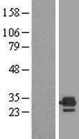 ls002109 etfb human over expression lysates nm 001985 wb testing 1