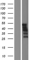 ls002115 er81 etv1 human over expression lysates nm 001163150 wb testing 3