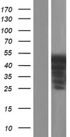 ls002115 er81 etv1 human over expression lysates nm 001163152 wb testing 5