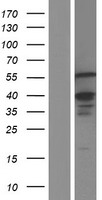 ETV3 Human Over-expression Lysates NM_001145312