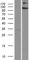Ellis van Creveld syndrome (EVC) Human Over-expression Lysates NM_153717
