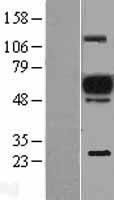 ls002123 evi2a human over expression lysates nm 014210 wb testing 1