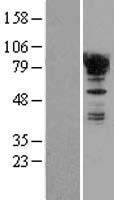 EWSR1 Human Over-expression Lysates NM_005243